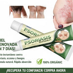 ✅ PSORIASIS™ |  Alivia la picazón y el enrojecimiento de la piel desde la primera aplicación ☀️